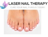 Laser Nail Therapy image 2